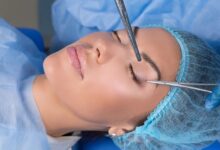 What is eyelid surgery