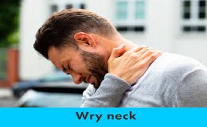 wry neck